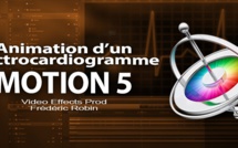 Motion 5 : Animation d'un électrocardiogramme